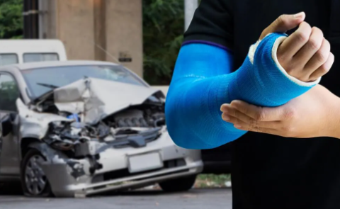 Maximizing Your Compensation for Broken Bones and Related Injuries After a Car Crash
