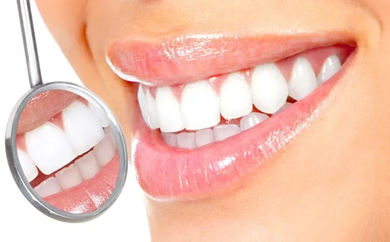 Why Preventive Dentistry Is Essential Before Bonding, Veneers, Or Whitening