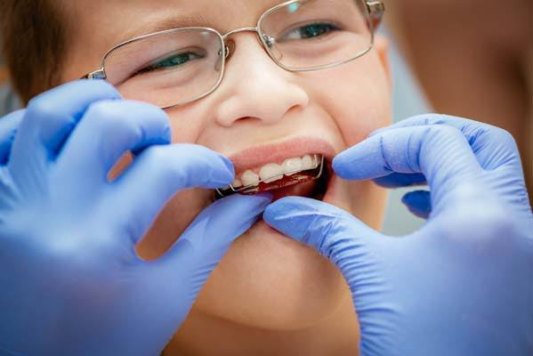How Pediatric Dentists Track Growth to Time Orthodontic Treatment