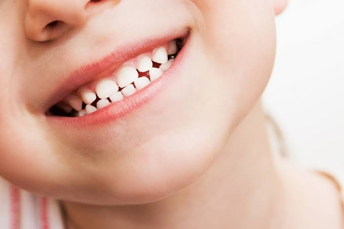 What Parents Should Know About Cleaning Behind Partially Erupted Teeth