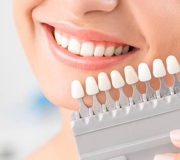 How Family Dentistry Simplifies Access to Whitening, Veneers, and More